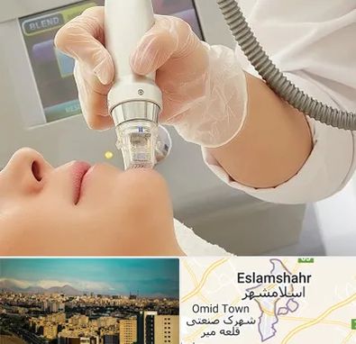 آر اف فرکشنال در اسلامشهر