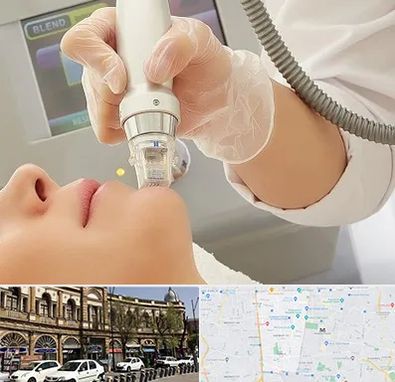 آر اف فرکشنال در منطقه 11 تهران 