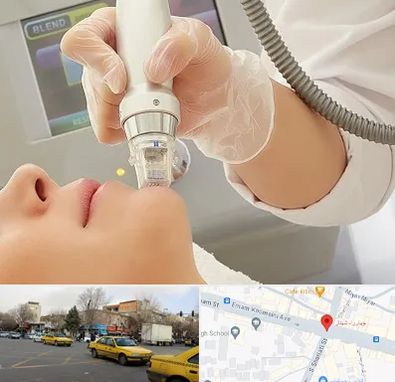 آر اف فرکشنال در شهناز تبریز