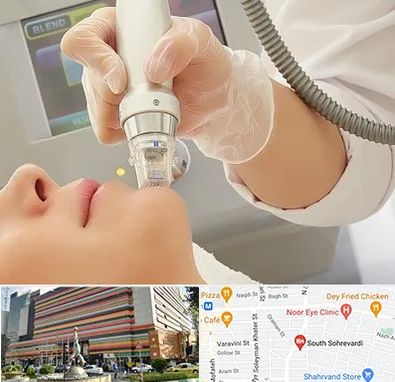 آر اف فرکشنال در سهروردی 