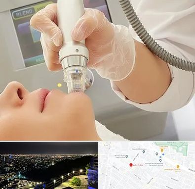 آر اف فرکشنال در هفت تیر مشهد 