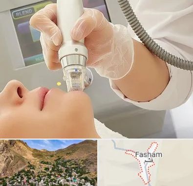 آر اف فرکشنال در فشم