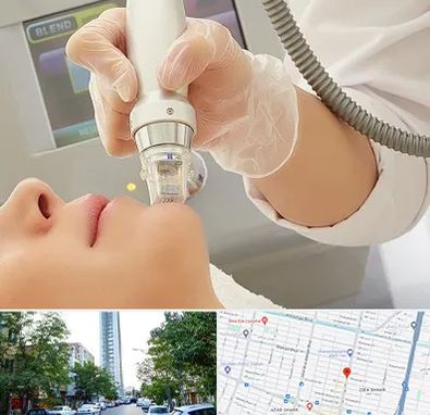 آر اف فرکشنال در امامت مشهد