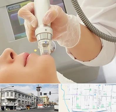 آر اف فرکشنال در 17شهریور