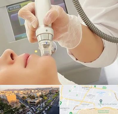 آر اف فرکشنال در تهرانپارس 