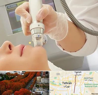 آر اف فرکشنال در ولیعصر 