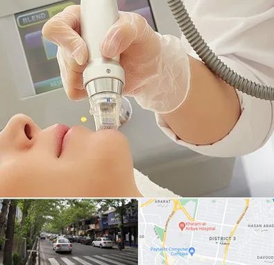 آر اف فرکشنال در ظفر 