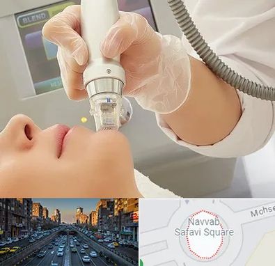 آر اف فرکشنال در نواب