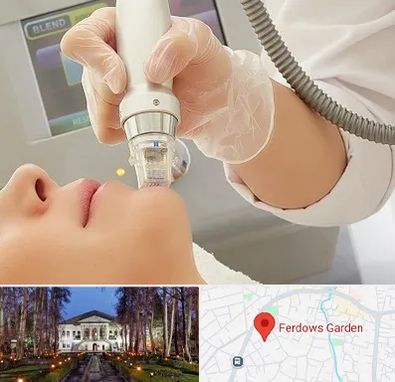 آر اف فرکشنال در باغ فردوس