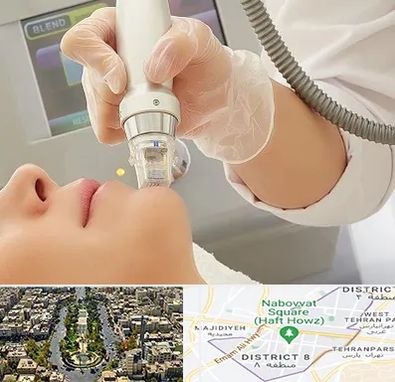 آر اف فرکشنال در نارمک 