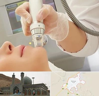 آر اف فرکشنال در شهرضا