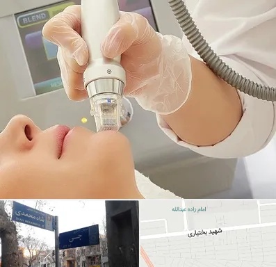 آر اف فرکشنال در سی متری جی