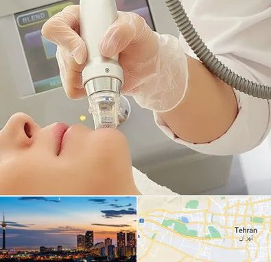 آر اف فرکشنال در غرب تهران 