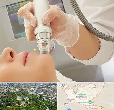 آر اف فرکشنال در شهرکرد