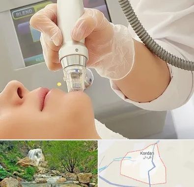 آر اف فرکشنال در کردان