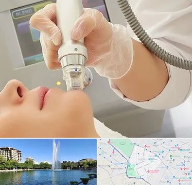 آر اف فرکشنال در کوهسنگی مشهد