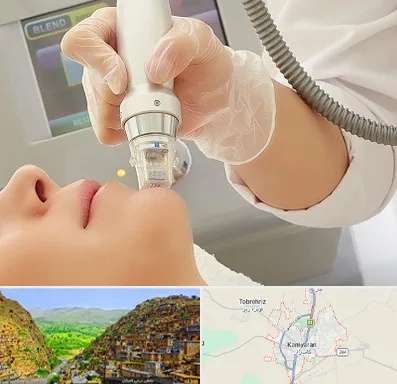 آر اف فرکشنال در کامیاران