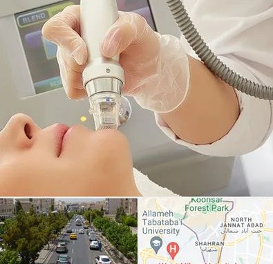 آر اف فرکشنال در شهران 