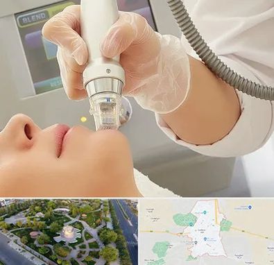 آر اف فرکشنال در کاشمر