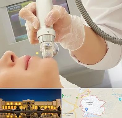 آر اف فرکشنال در برازجان