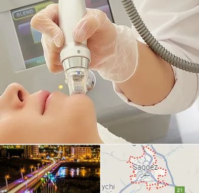 آر اف فرکشنال در سقز