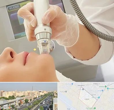 آر اف فرکشنال در کیانمهر کرج