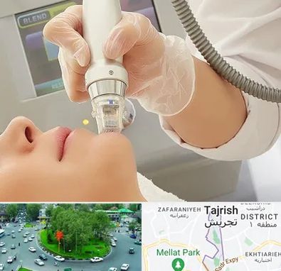 آر اف فرکشنال در تجریش 