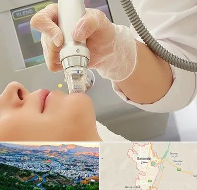 آر اف فرکشنال در سنندج