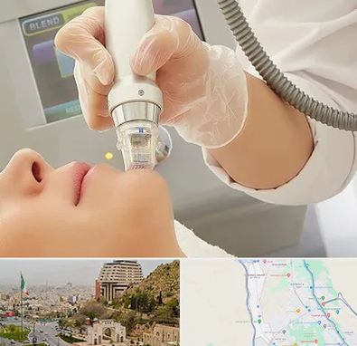 آر اف فرکشنال در فرهنگ شهر شیراز