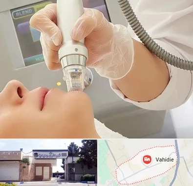 آر اف فرکشنال در وحیدیه شهریار