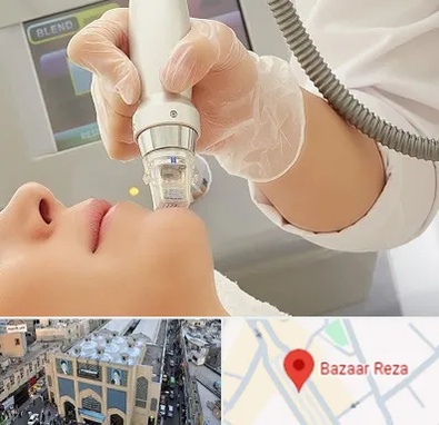 آر اف فرکشنال در بازار رضا مشهد