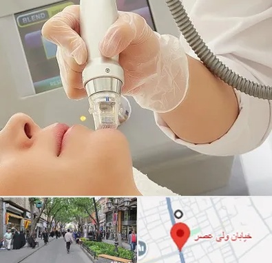 آر اف فرکشنال در ولیعصر شهریار