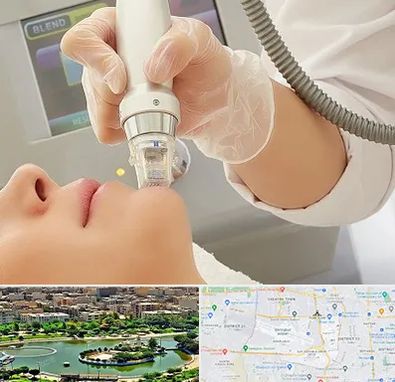 آر اف فرکشنال در منطقه 9 تهران 