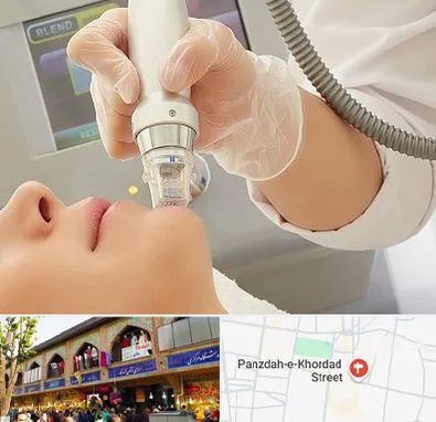 آر اف فرکشنال در 15 خرداد