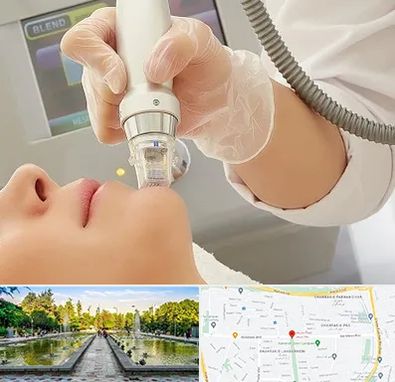 آر اف فرکشنال در سرسبز 