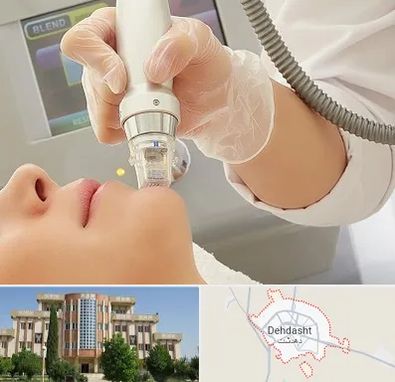 آر اف فرکشنال در دهدشت