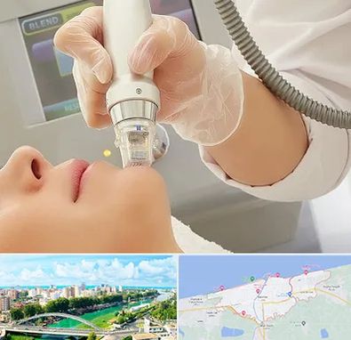 آر اف فرکشنال در بابلسر