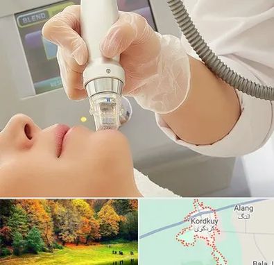 آر اف فرکشنال در کردکوی