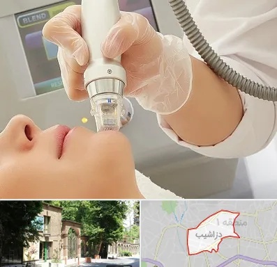 آر اف فرکشنال در دزاشیب