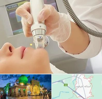 آر اف فرکشنال در آستانه اشرفیه