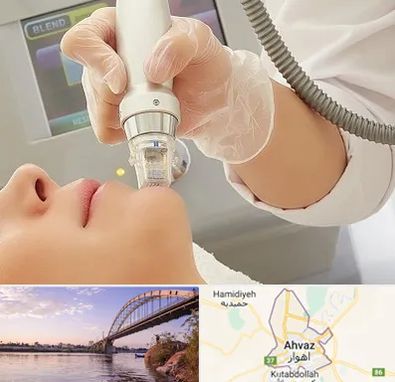 آر اف فرکشنال در اهواز