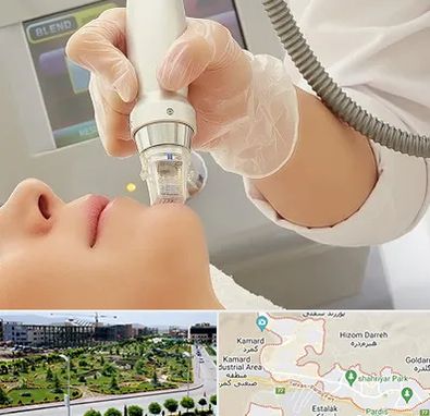 آر اف فرکشنال در پردیس