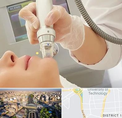 آر اف فرکشنال در استاد معین 