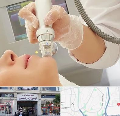 آر اف فرکشنال در ایران زمین