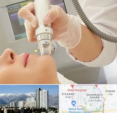 آر اف فرکشنال در شهرک غرب 