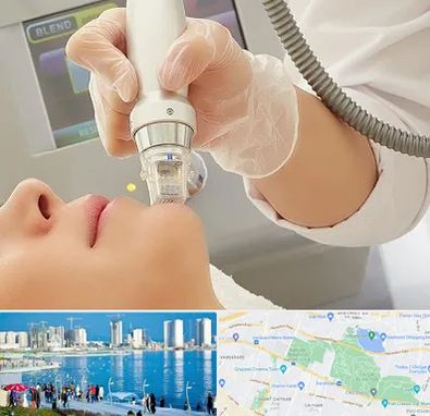 آر اف فرکشنال در چیتگر 