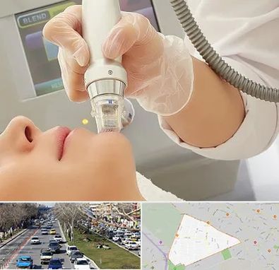 آر اف فرکشنال در احمدآباد مشهد 