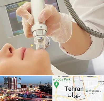 آر اف فرکشنال در صادقیه 