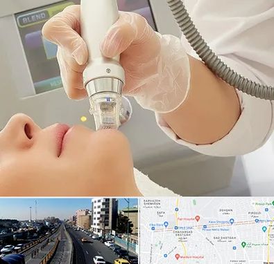 آر اف فرکشنال در پیروزی 