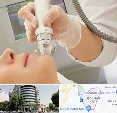 آر اف فرکشنال در قلهک 